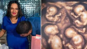 madre y bebés permanecen bajo observación