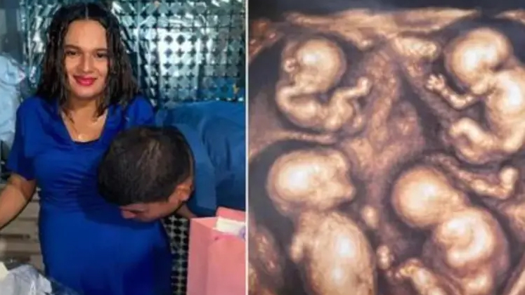 madre y bebés permanecen bajo observación